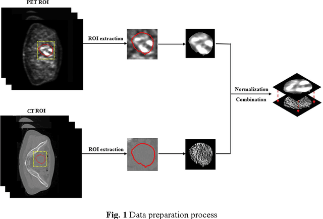 Figure 1 for An attention-based deep learning network for predicting Platinum resistance in ovarian cancer