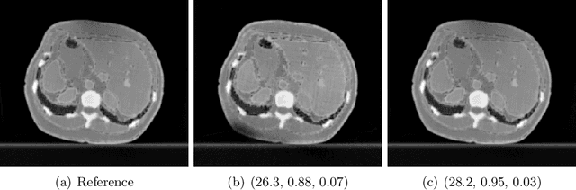 Figure 4 for A study of why we need to reassess full reference image quality assessment with medical images