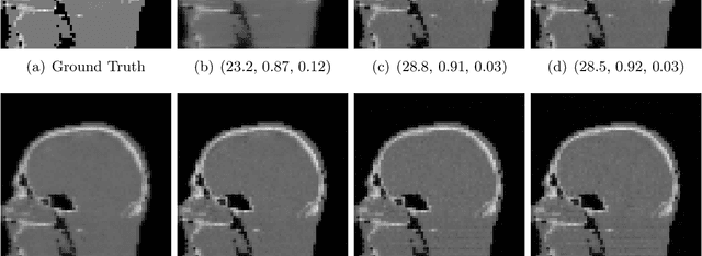 Figure 2 for A study of why we need to reassess full reference image quality assessment with medical images