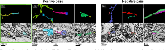 Figure 3 for Learning Multimodal Volumetric Features for Large-Scale Neuron Tracing