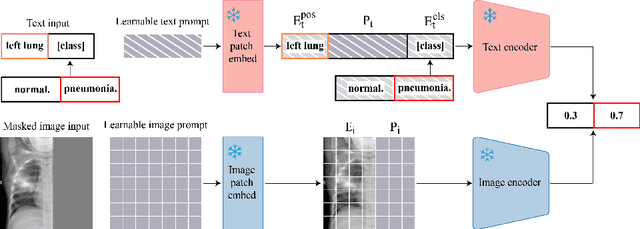 Figure 1 for Position-Guided Prompt Learning for Anomaly Detection in Chest X-Rays