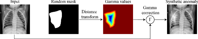 Figure 3 for Position-Guided Prompt Learning for Anomaly Detection in Chest X-Rays