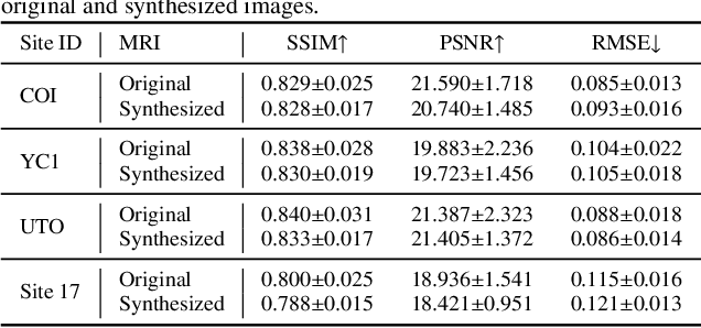 Figure 4 for Disentangled Latent Energy-Based Style Translation: An Image-Level Structural MRI Harmonization Framework