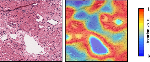 Figure 1 for AV-GAN: Attention-Based Varifocal Generative Adversarial Network for Uneven Medical Image Translation