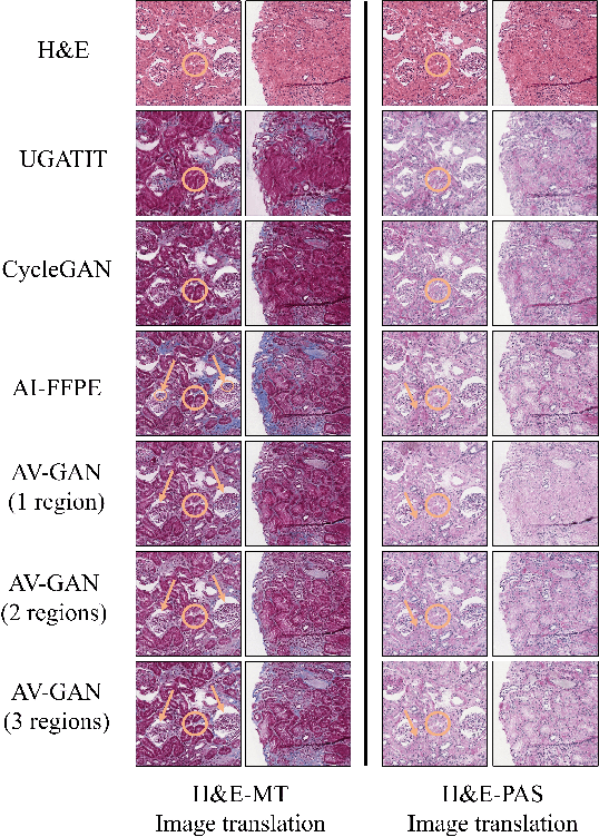 Figure 4 for AV-GAN: Attention-Based Varifocal Generative Adversarial Network for Uneven Medical Image Translation