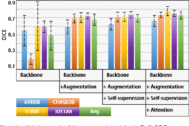 Figure 2 for RaffeSDG: Random Frequency Filtering enabled Single-source Domain Generalization for Medical Image Segmentation