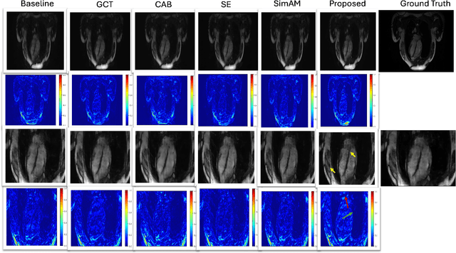 Figure 2 for Accelerating Cardiac MRI Reconstruction with CMRatt: An Attention-Driven Approach