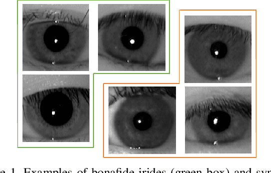 Figure 1 for Synthesizing Iris Images using Generative Adversarial Networks: Survey and Comparative Analysis