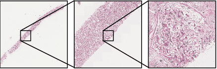Figure 3 for Ultra-Resolution Cascaded Diffusion Model for Gigapixel Image Synthesis in Histopathology