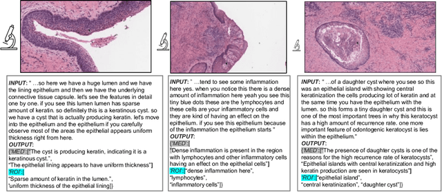 Figure 3 for Quilt-1M: One Million Image-Text Pairs for Histopathology