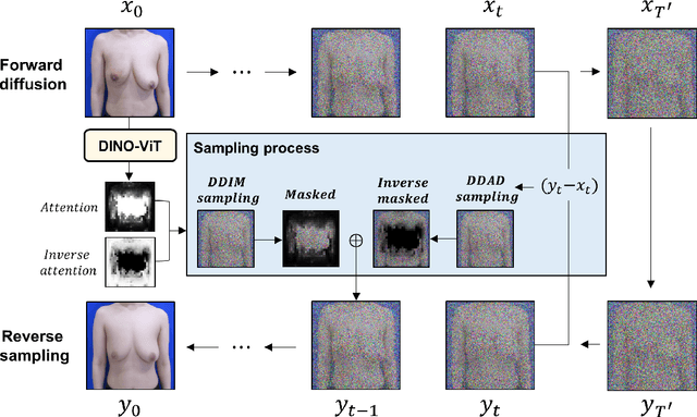 Figure 1 for Objective and Interpretable Breast Cosmesis Evaluation with Attention Guided Denoising Diffusion Anomaly Detection Model