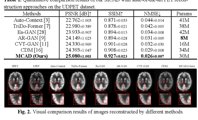 Figure 2 for MCAD: Multi-modal Conditioned Adversarial Diffusion Model for High-Quality PET Image Reconstruction