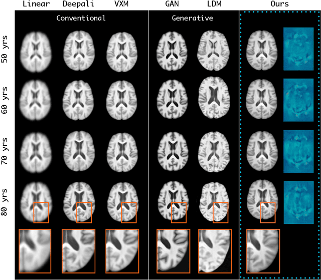 Figure 3 for Diff-Def: Diffusion-Generated Deformation Fields for Conditional Atlases