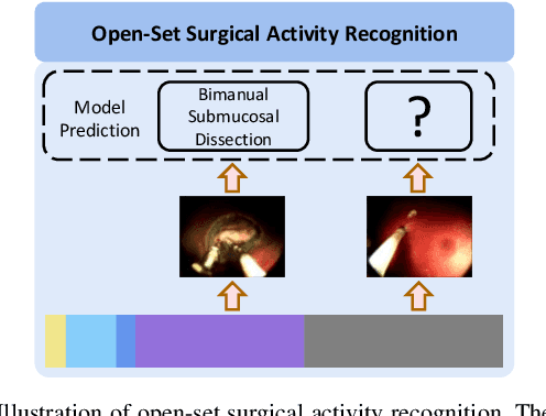 Figure 1 for OSSAR: Towards Open-Set Surgical Activity Recognition in Robot-assisted Surgery