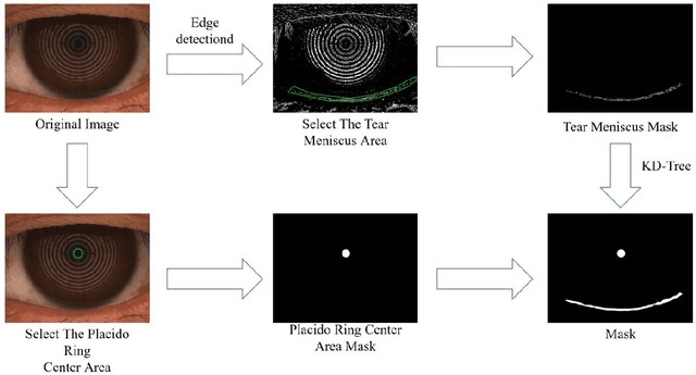 Figure 1 for An edge detection-based deep learning approach for tear meniscus height measurement