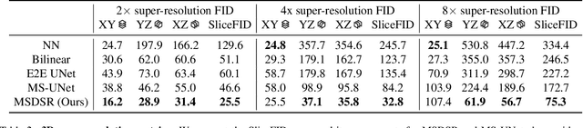 Figure 4 for Super-resolution of biomedical volumes with 2D supervision