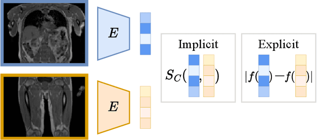 Figure 3 for Metrics to Quantify Global Consistency in Synthetic Medical Images