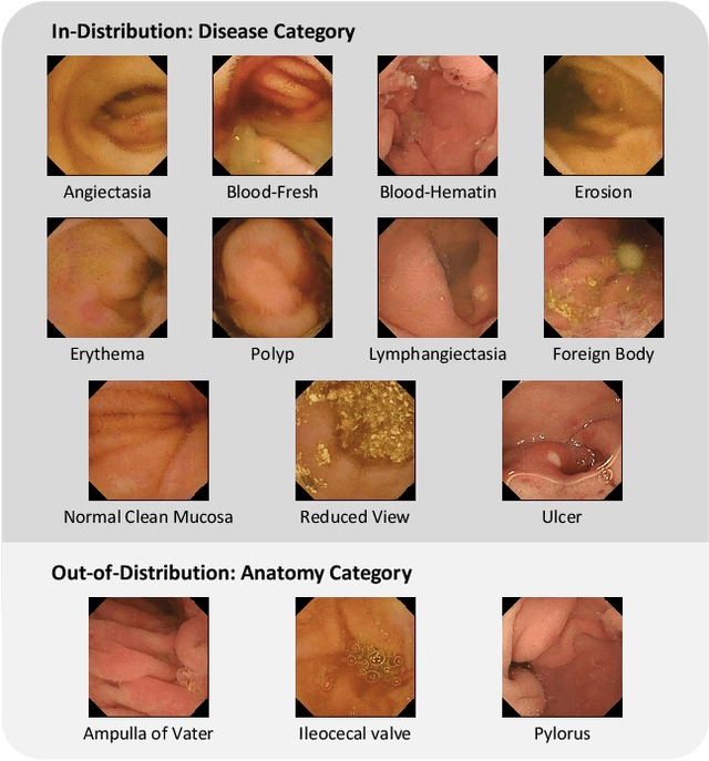 Figure 1 for EndoOOD: Uncertainty-aware Out-of-distribution Detection in Capsule Endoscopy Diagnosis