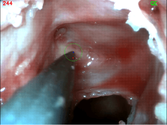 Figure 2 for The Quiet Eye Phenomenon in Minimally Invasive Surgery