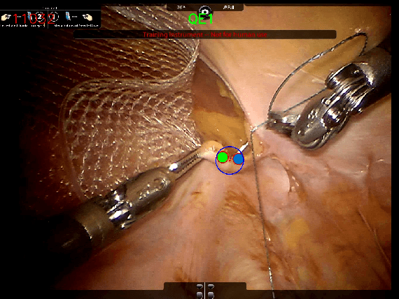 Figure 3 for The Quiet Eye Phenomenon in Minimally Invasive Surgery