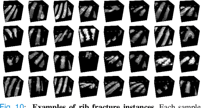 Figure 2 for Deep Rib Fracture Instance Segmentation and Classification from CT on the RibFrac Challenge