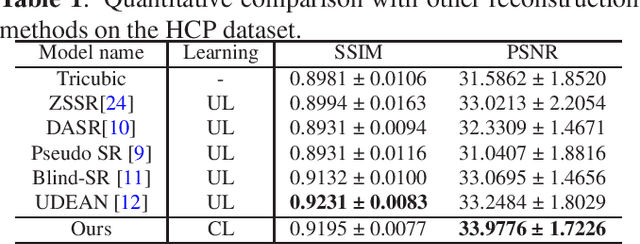 Figure 2 for Unpaired MRI Super Resolution with Self-Supervised Contrastive Learning