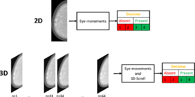 Figure 1 for Convolutional Neural Network Model Observers Discount Signal-like Anatomical Structures During Search in Virtual Digital Breast Tomosynthesis Phantoms