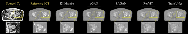 Figure 3 for I2I-Mamba: Multi-modal medical image synthesis via selective state space modeling