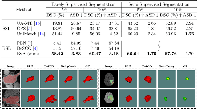 Figure 4 for Rethinking Barely-Supervised Segmentation from an Unsupervised Domain Adaptation Perspective