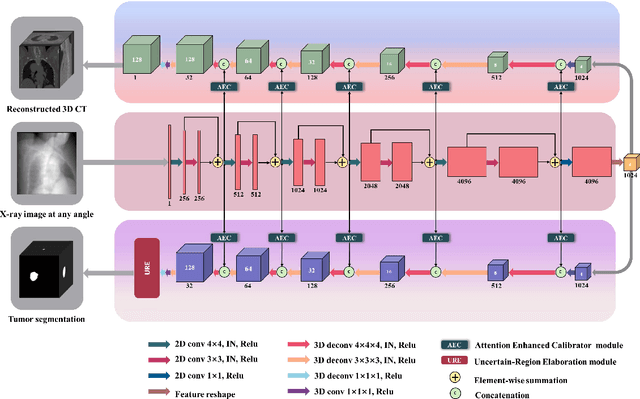 Figure 1 for RT-SRTS: Angle-Agnostic Real-Time Simultaneous 3D Reconstruction and Tumor Segmentation from Single X-Ray Projection