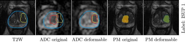 Figure 2 for Deformable MRI Sequence Registration for AI-based Prostate Cancer Diagnosis