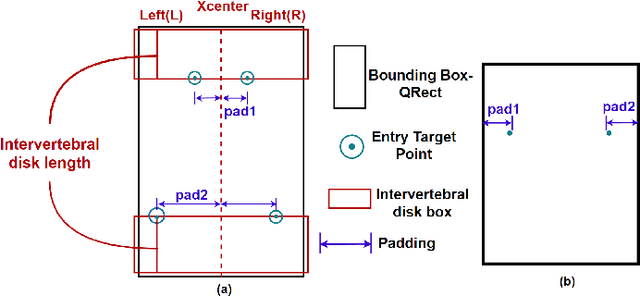 Figure 3 for GUI-based Pedicle Screw Planning on Fluoroscopic Images Utilizing Vertebral Segmentation