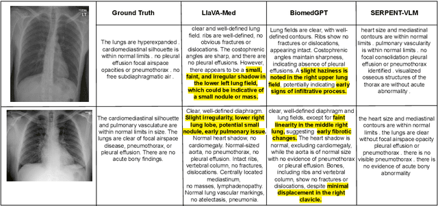 Figure 1 for SERPENT-VLM : Self-Refining Radiology Report Generation Using Vision Language Models