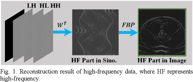 Figure 1 for Stage-by-stage Wavelet Optimization Refinement Diffusion Model for Sparse-View CT Reconstruction