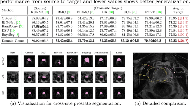 Figure 2 for Domain Game: Disentangle Anatomical Feature for Single Domain Generalized Segmentation