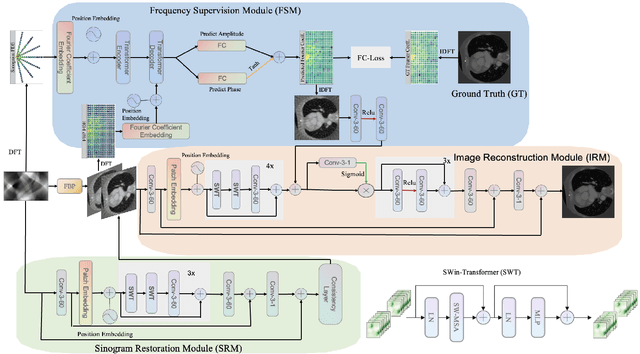 Figure 1 for TD-Net: A Tri-domain network for sparse-view CT reconstruction