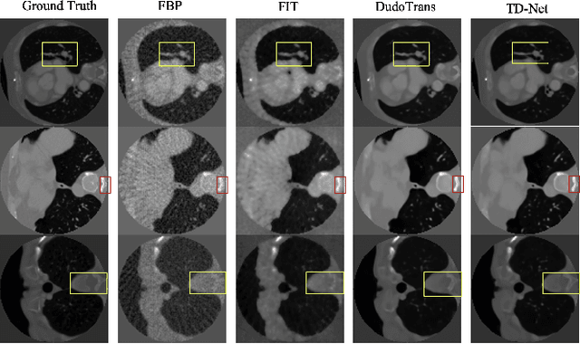 Figure 3 for TD-Net: A Tri-domain network for sparse-view CT reconstruction