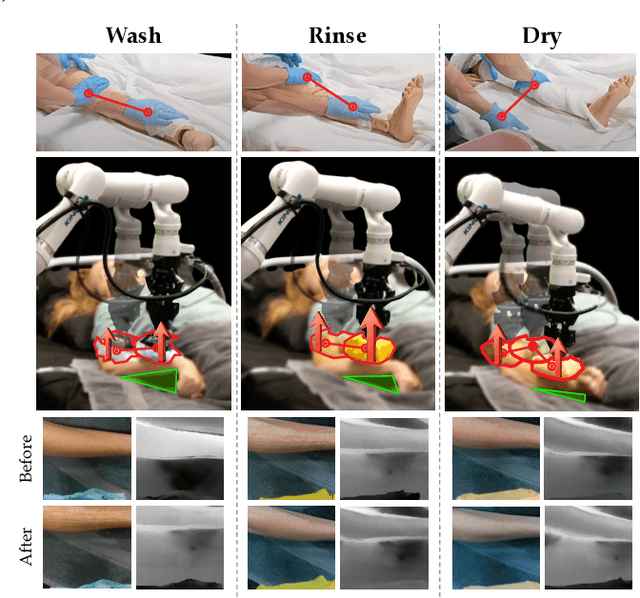 Figure 1 for RABBIT: A Robot-Assisted Bed Bathing System with Multimodal Perception and Integrated Compliance