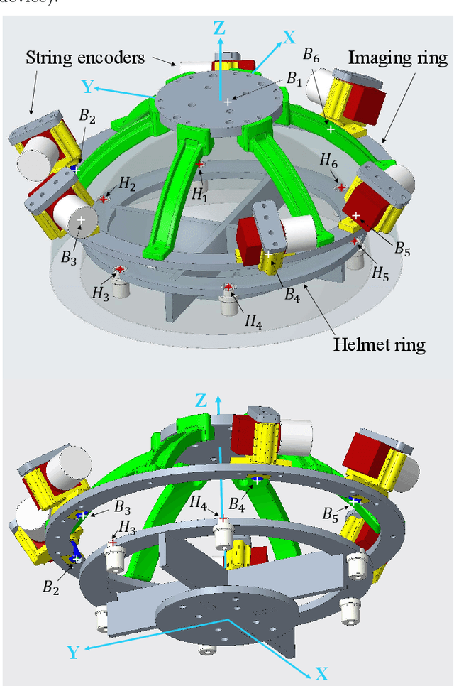 Figure 3 for Calibration and evaluation of a motion measurement system for PET imaging studies