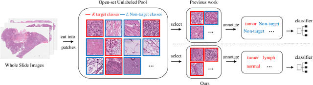 Figure 1 for OpenAL: An Efficient Deep Active Learning Framework for Open-Set Pathology Image Classification