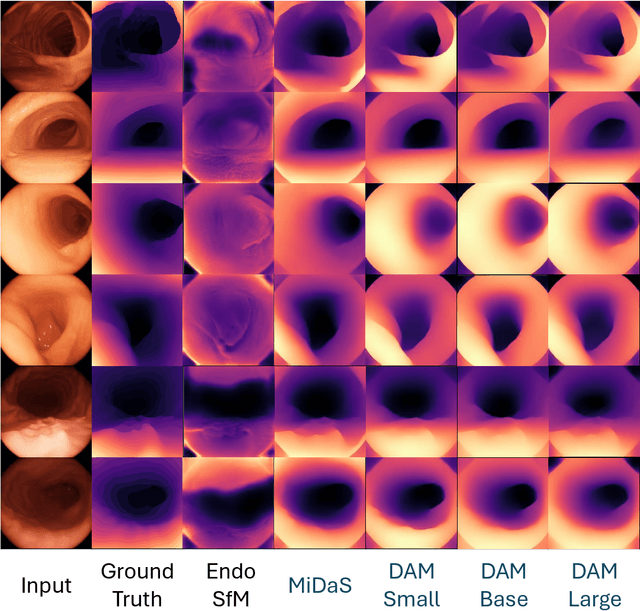 Figure 1 for Depth Anything in Medical Images: A Comparative Study