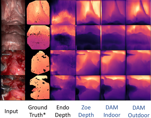 Figure 3 for Depth Anything in Medical Images: A Comparative Study