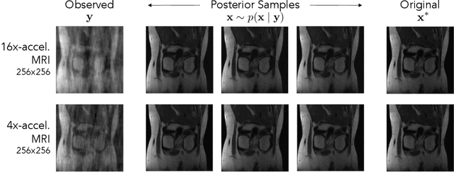 Figure 1 for Efficient Bayesian Computational Imaging with a Surrogate Score-Based Prior