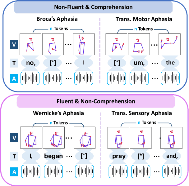 Figure 1 for Learning Co-Speech Gesture for Multimodal Aphasia Type Detection