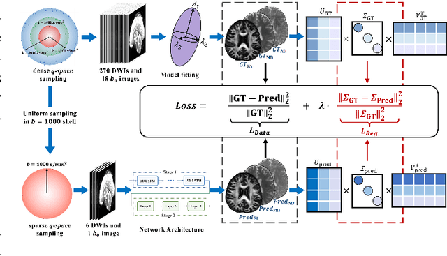 Figure 1 for AID-DTI: Accelerating High-fidelity Diffusion Tensor Imaging with Detail-Preserving Model-based Deep Learning