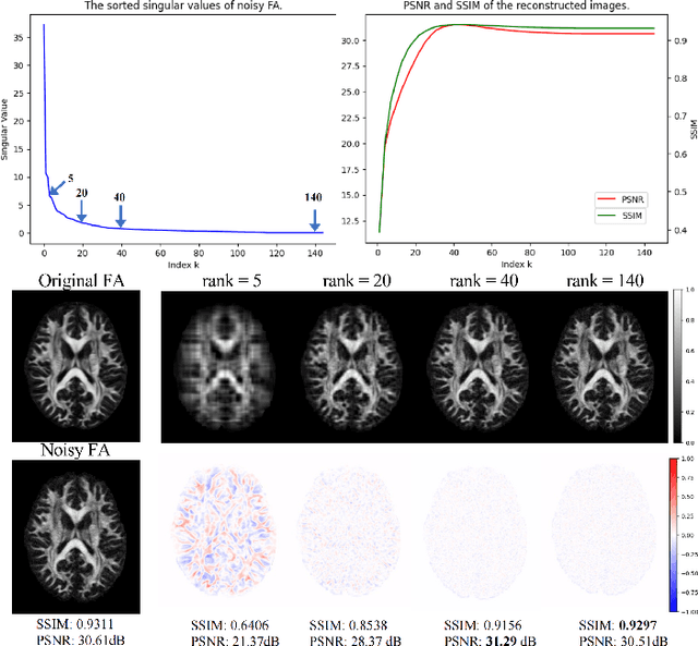 Figure 3 for AID-DTI: Accelerating High-fidelity Diffusion Tensor Imaging with Detail-Preserving Model-based Deep Learning