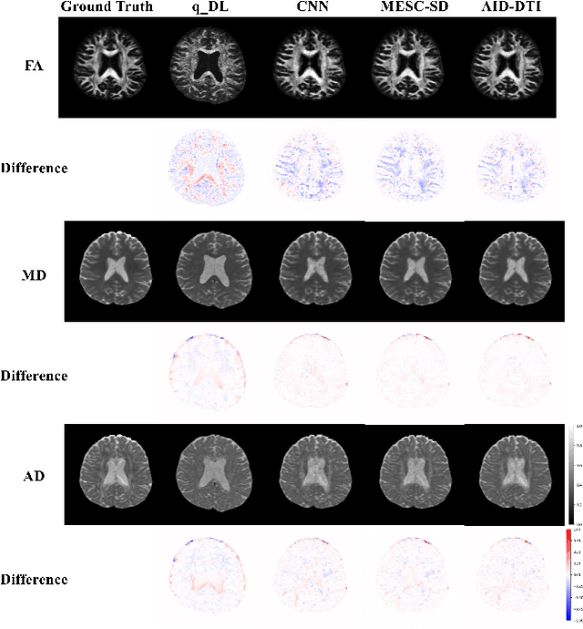 Figure 4 for AID-DTI: Accelerating High-fidelity Diffusion Tensor Imaging with Detail-Preserving Model-based Deep Learning