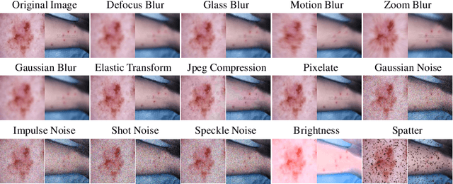 Figure 1 for Diffusion Model Driven Test-Time Image Adaptation for Robust Skin Lesion Classification