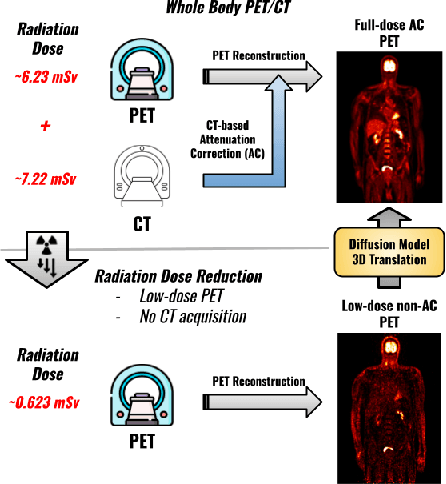 Figure 1 for 2.5D Multi-view Averaging Diffusion Model for 3D Medical Image Translation: Application to Low-count PET Reconstruction with CT-less Attenuation Correction