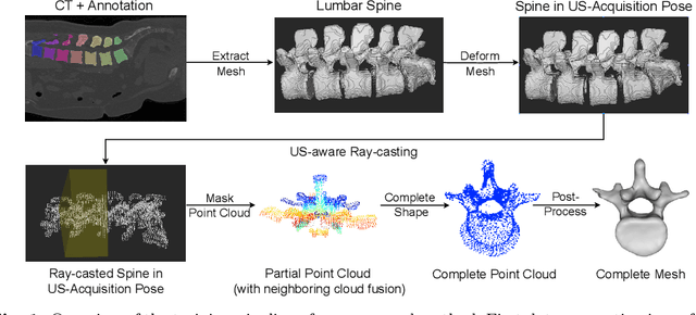 Figure 1 for Shape Completion in the Dark: Completing Vertebrae Morphology from 3D Ultrasound